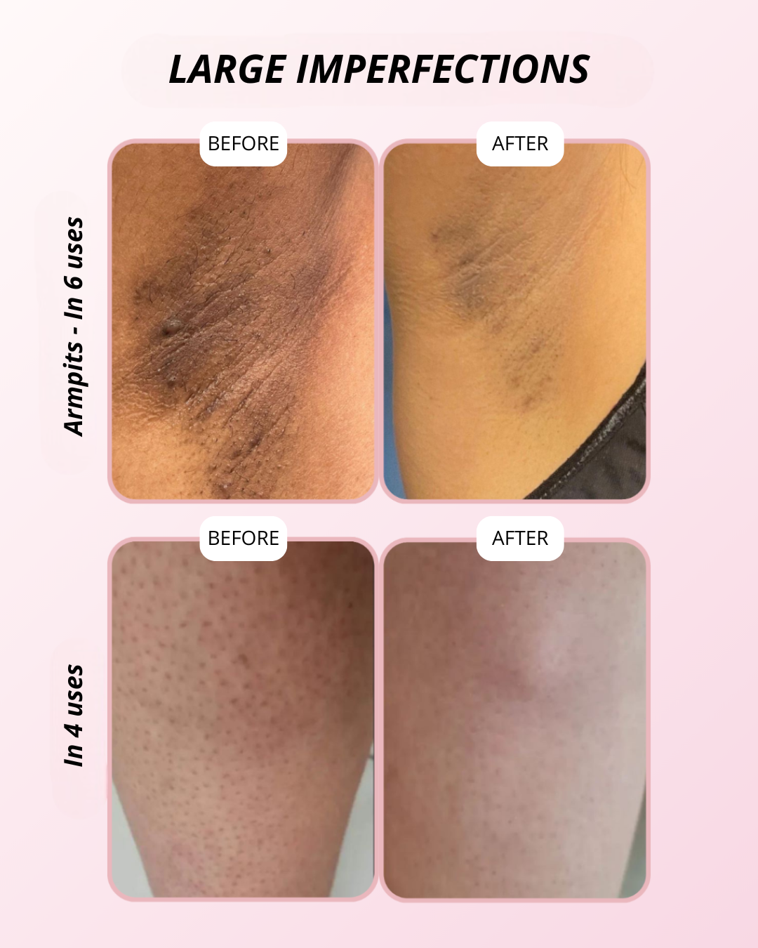 Silk exfoliating glove